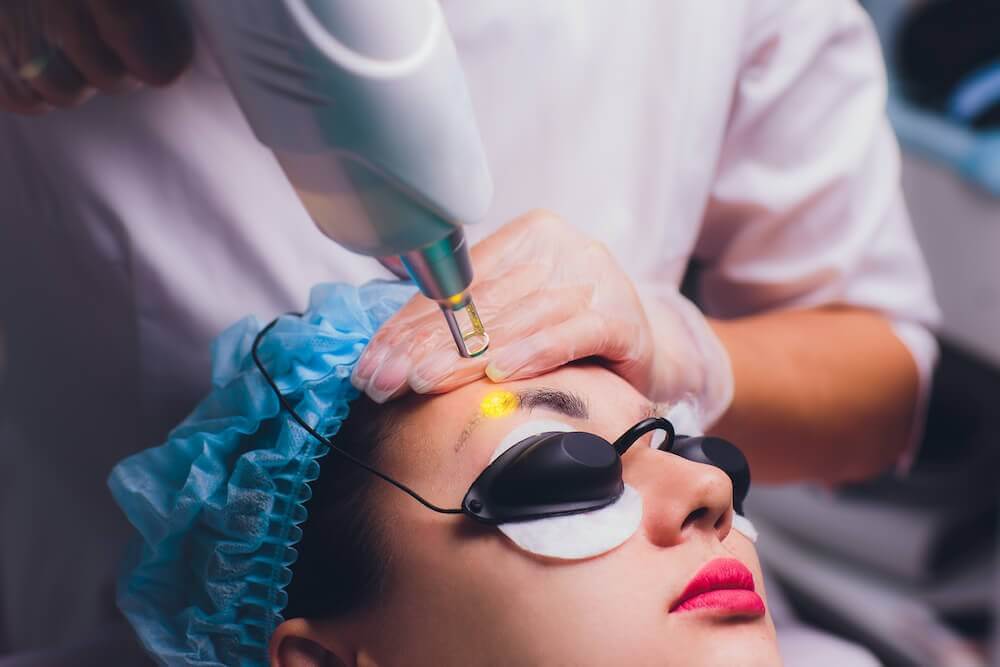 Laser Eyebrow Tattoo Removal: What You Need to Know Before Starting